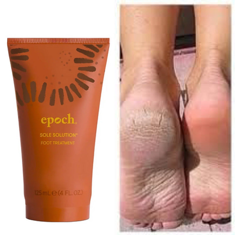 Epoch Sole Solution